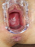 409_078_wide-spread-vulva-stretched-pussy
