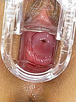 262_051_bella_ling_speculum