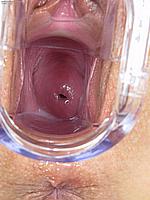 274_096_wet-clit-deep-speculum