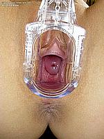 406_085_cervix-speculum-teen-pussy